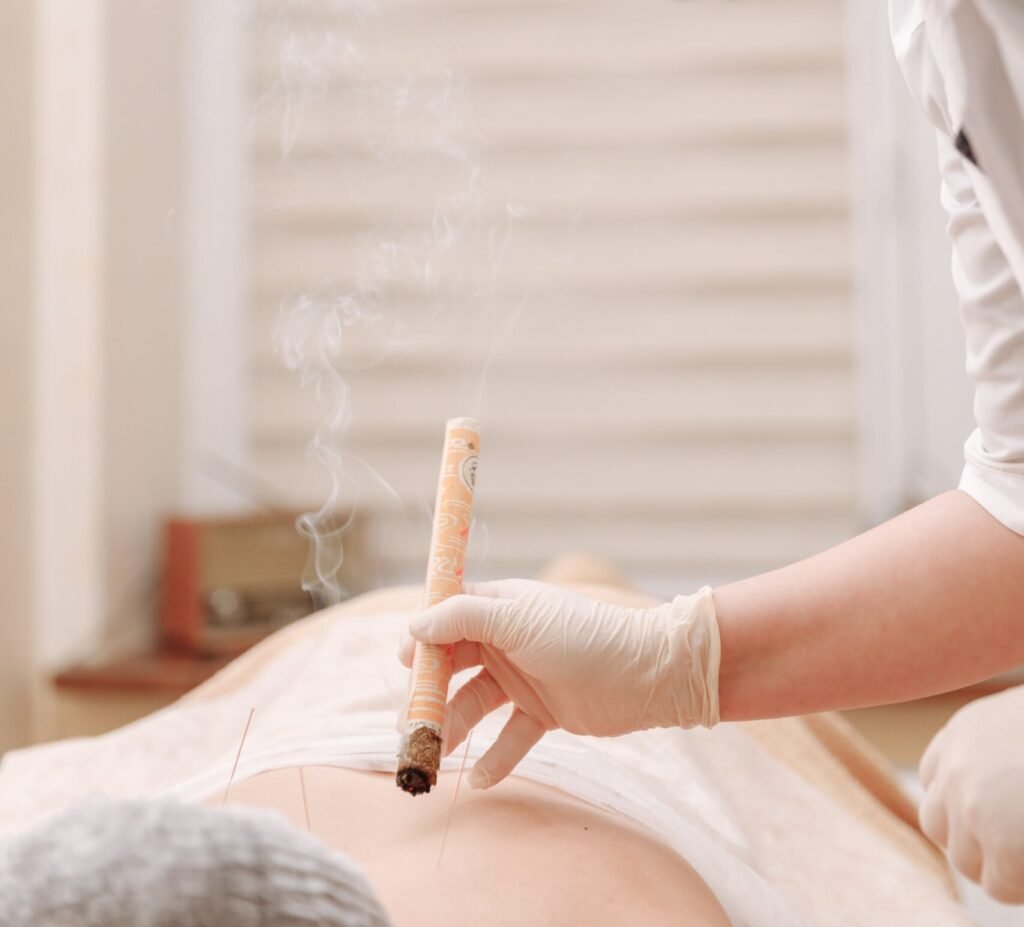 acupuntura y moxibustion, medicina tradicional china en medellin
