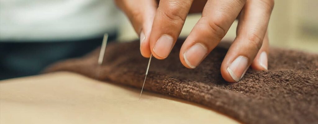 Agujas de acupuntura