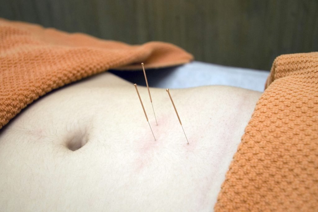 puntos para la inflamación abdominal