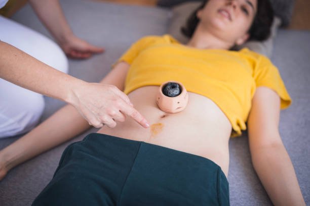 moxibustion indirecta                                                                                                