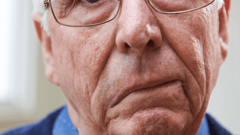 Paciente  anciano con parálisis Facial