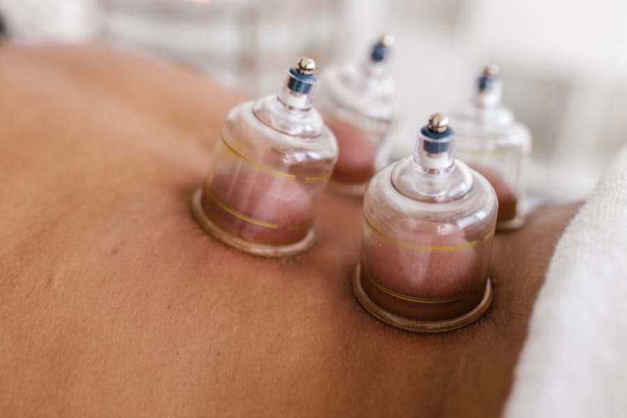 Ventosas Chinas para Contracturas Musculares 3 Ventosas chinas para las Contracturas musculares