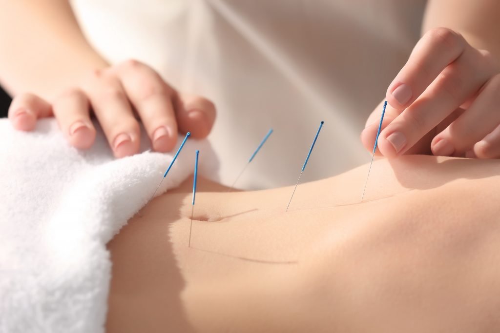 Acupuntura para la obesidad: Un Viaje Energético hacia el Equilibrio 2 acupuntura para la obesidad