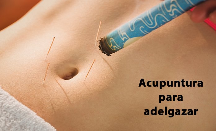 Acupuntura para la obesidad: Un Viaje Energético hacia el Equilibrio 3 acupuntura para la obesidad en general