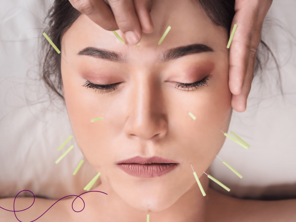 Inicio 14 Acupuntura para aliviar los síntomas de la menopausia 2