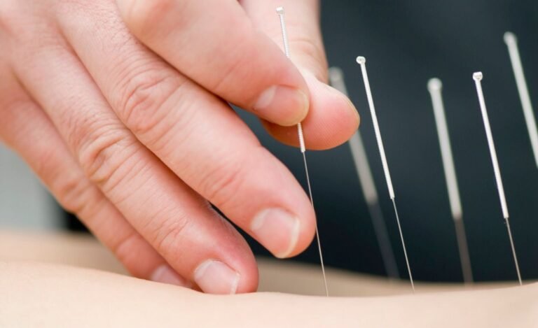 Acupuntura para Bajar de Peso: Beneficios, Técnicas y Evidencia Científica