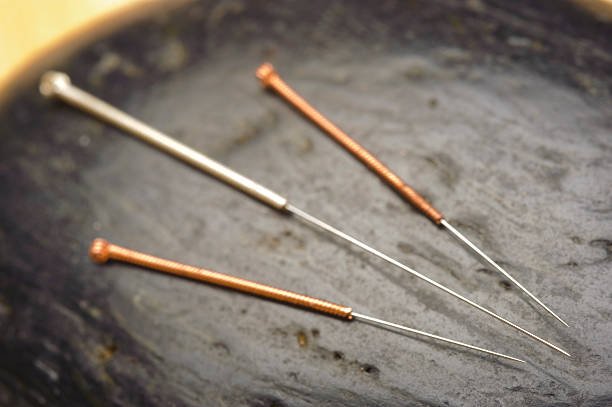 6 Herramientas Ancestrales de la MTC: Más Allá de las Agujas de Acupuntura 7 agujas china con mango y cabeza de acupuntura de acero y cobre