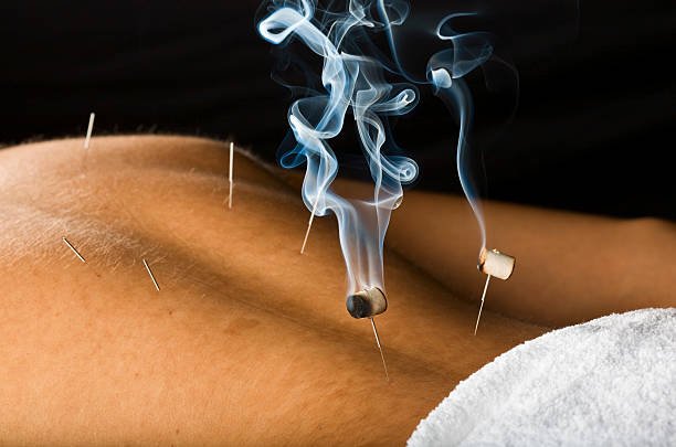 6 Herramientas Ancestrales de la MTC: Más Allá de las Agujas de Acupuntura 8 moxibustion en agujas de acupuntura, moxibustion indirecta
