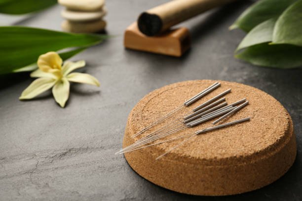 6 Herramientas Ancestrales de la MTC: Más Allá de las Agujas de Acupuntura 2 agujas de acupuntura japonesas