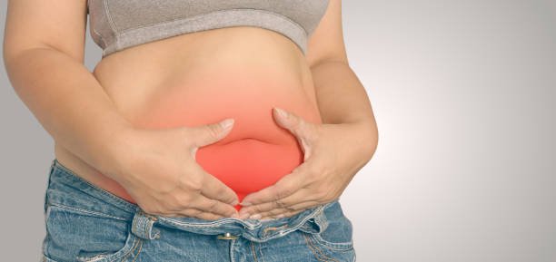 Tratamiento Integral de la Colitis Ulcerosa: 1 Enfoque Basado en Evidencia y Medicina Alternativa 2 Colitis Ulcerosa
