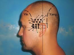 Craneoacupuntura: Integración de la Medicina Tradicional China y la Neurociencia Moderna en la Rehabilitación Neurológica 2 la craneopuntura