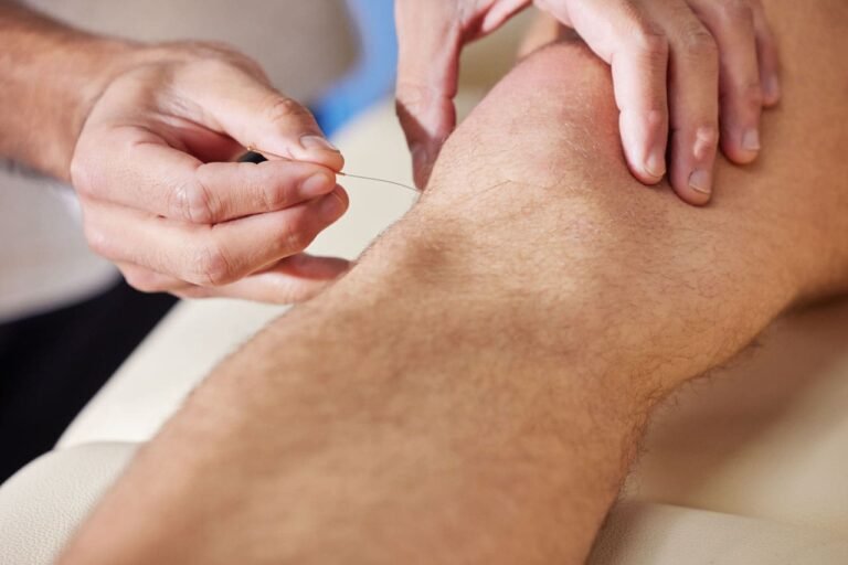 Los beneficios de la acupuntura: una guía completa y basada en evidencia