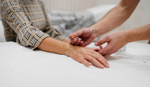 🪡 5 señales de que podrías beneficiarte de una sesión de acupuntura 1 ACUPUNTIRA EN LA MANO