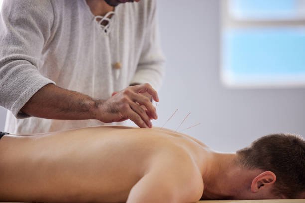 🪡 5 señales de que podrías beneficiarte de una sesión de acupuntura 4 ACUPUNTURA EN ESPALDA ALTA PARA DOLOR DE ESPALDA