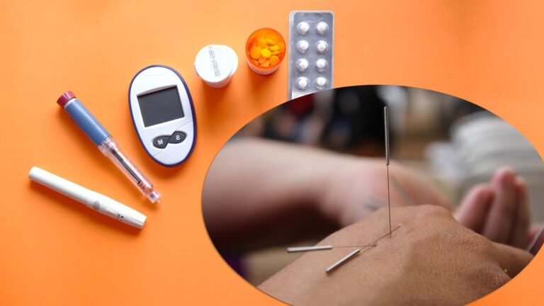 Tratamiento acupuntural de la Diabetes tipo 2