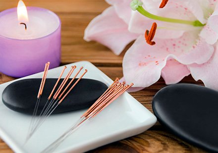 Acupuntura en aliviate conmigo en Medellin 6 la alquimia energética del consultorio medico aliviate en medellin colombia