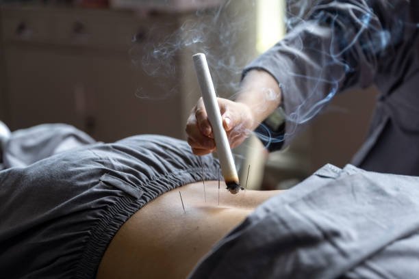 Acupuntura en aliviate conmigo en Medellin 4 acupuntura y moxibustion en aliviate conmigo