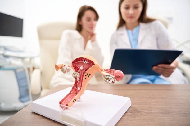 Acupuntura para miomas uterinos 4 miomas y coherencia, simbología de los miomas