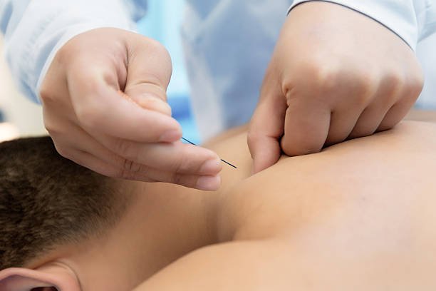 Bursitis y Tendinitis del Bíceps: una visión desde la Medicina Tradicional China 5
