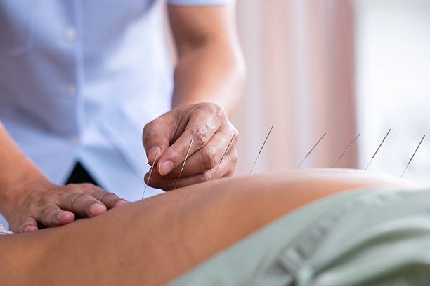 🈶 Todas las Terapias de la Medicina China Tradicional: Guía Completa y Profunda de Aliviate Conmigo 3 acupuntura china tradicional