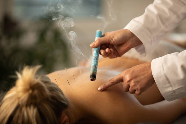 cuantas sesiones de acupuntura son necesarias