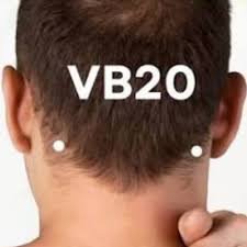 Acupuntura para el Vértigo 5