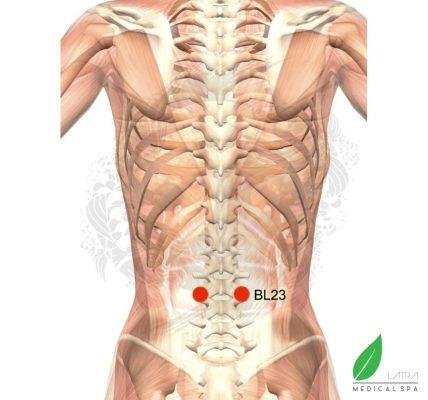 Punto BL23 Shenshu — agujas bilaterales en la zona lumbar, punto shu posterior del Riñón