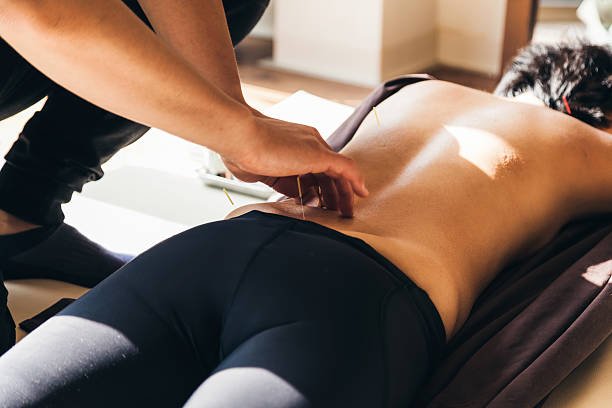 acupuntura para el dolor de espalda