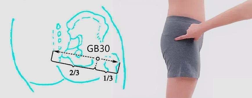 Punto GB30 Huantiao en la cadera lateral — acupuntura para el dolor que irradia por la pierna