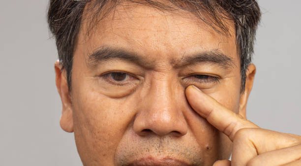 Acupuntura para parálisis facial: agujas en puntos del rostro según la Medicina Tradicional China – Consultorio Alíviate, Medellín